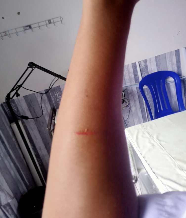 Perkelahian Antara Siswa di SMAN 10 Tanakeke, Diduga Akibat Miras